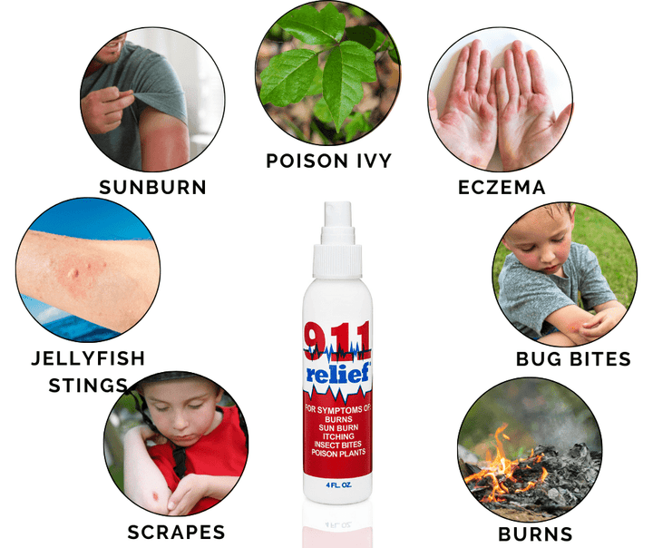 911 Relief 911 Relief Fast Acting Itch Relief for Sunburn, Poison Ivy, and Mosquito/Bug Bites & Jelly Fish Sting